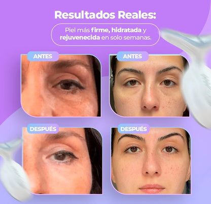 Masajeador Reductor de Arrugas y Papada + Serum de REGALO