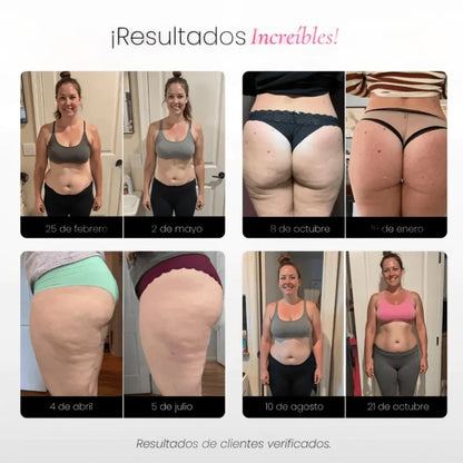 PROMO 2X1 | Leggings 3D Tecnología Anti-Celulitis